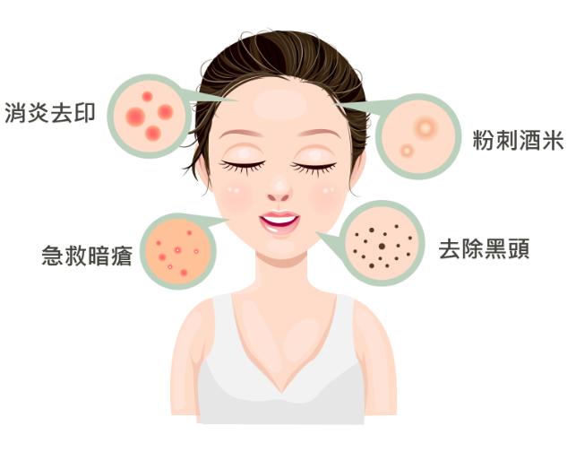 暗瘡成因有哪些？深度解析去暗瘡方法與成因！ - Pink Beauty 維渼樘